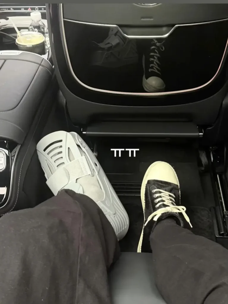 RM from BTS - ankle injury