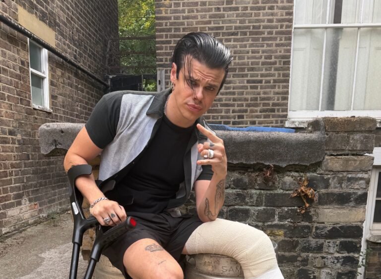 Yungblud Breaks Leg In Motorcycle Accident But Vows To Keep Gigging
