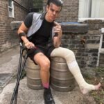 Yungblud with a broken leg