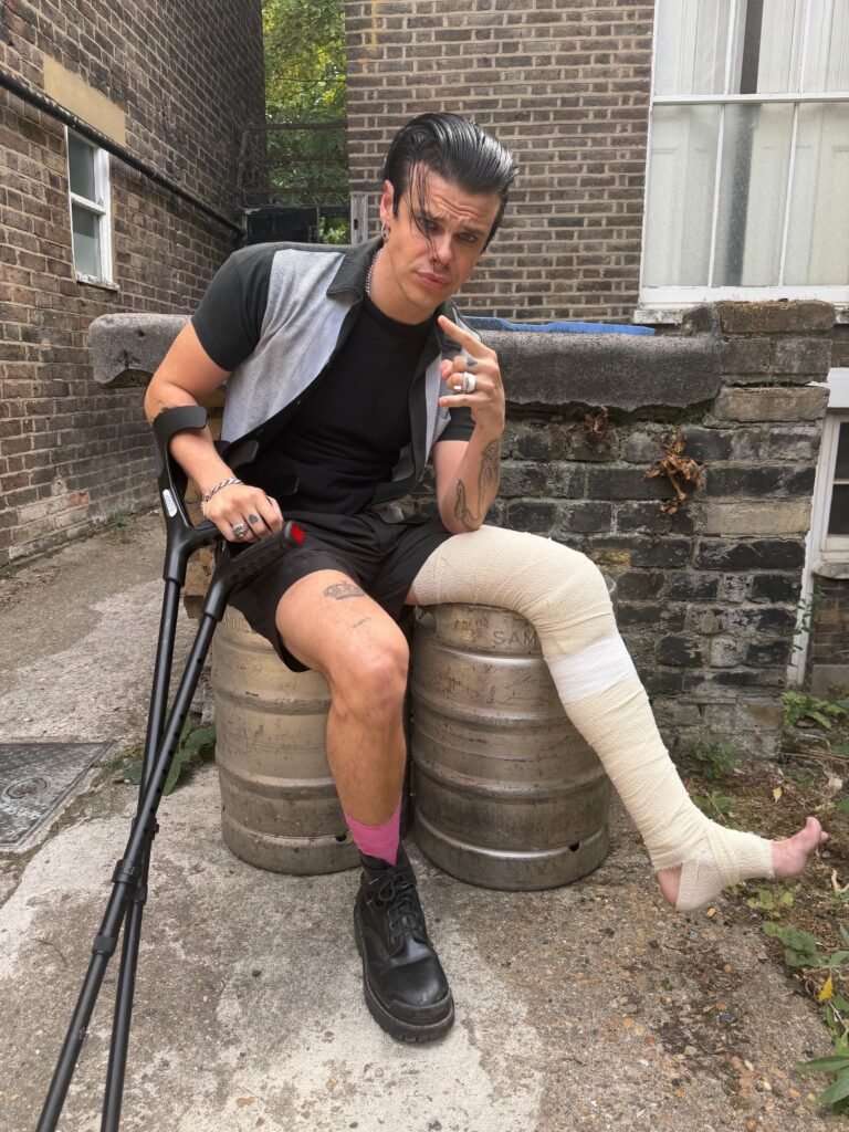 Yungblud with a broken leg